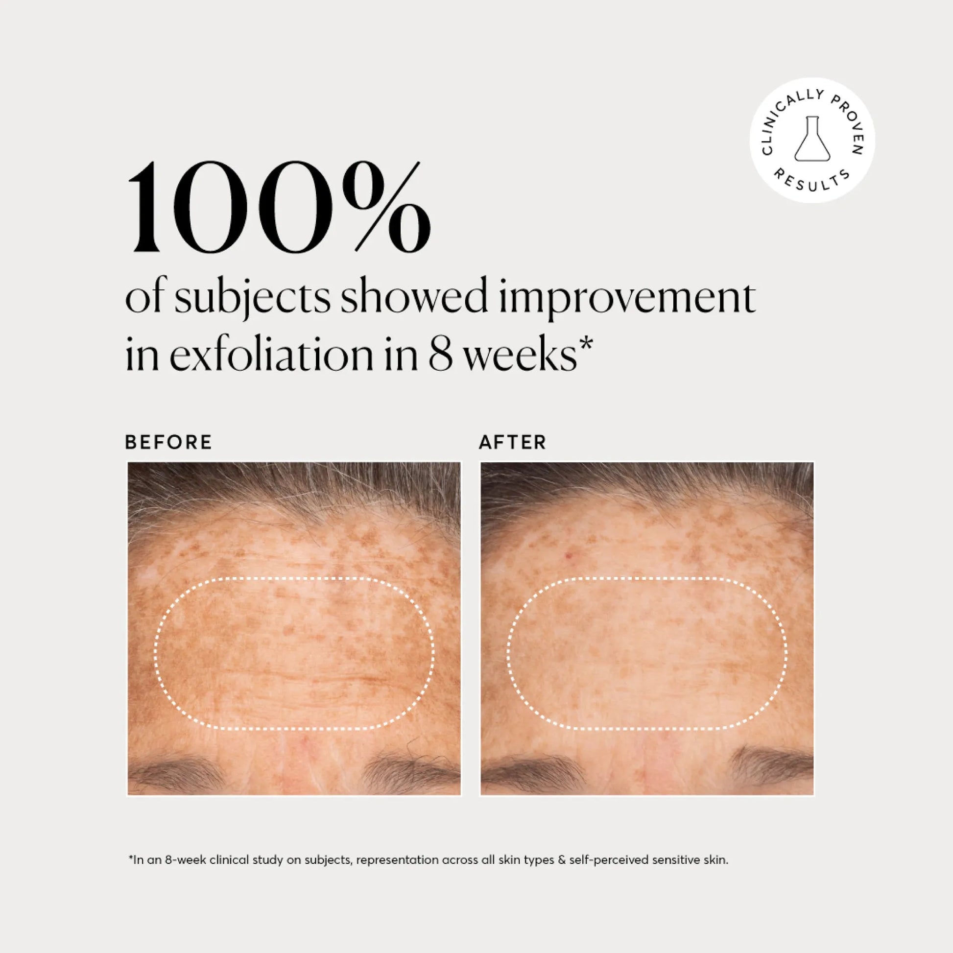 bha-liquid-exfoliant-2-d4 NATR-10027-Alt-Images-BHA-Liquid-Exfoliant-2_-03.webp