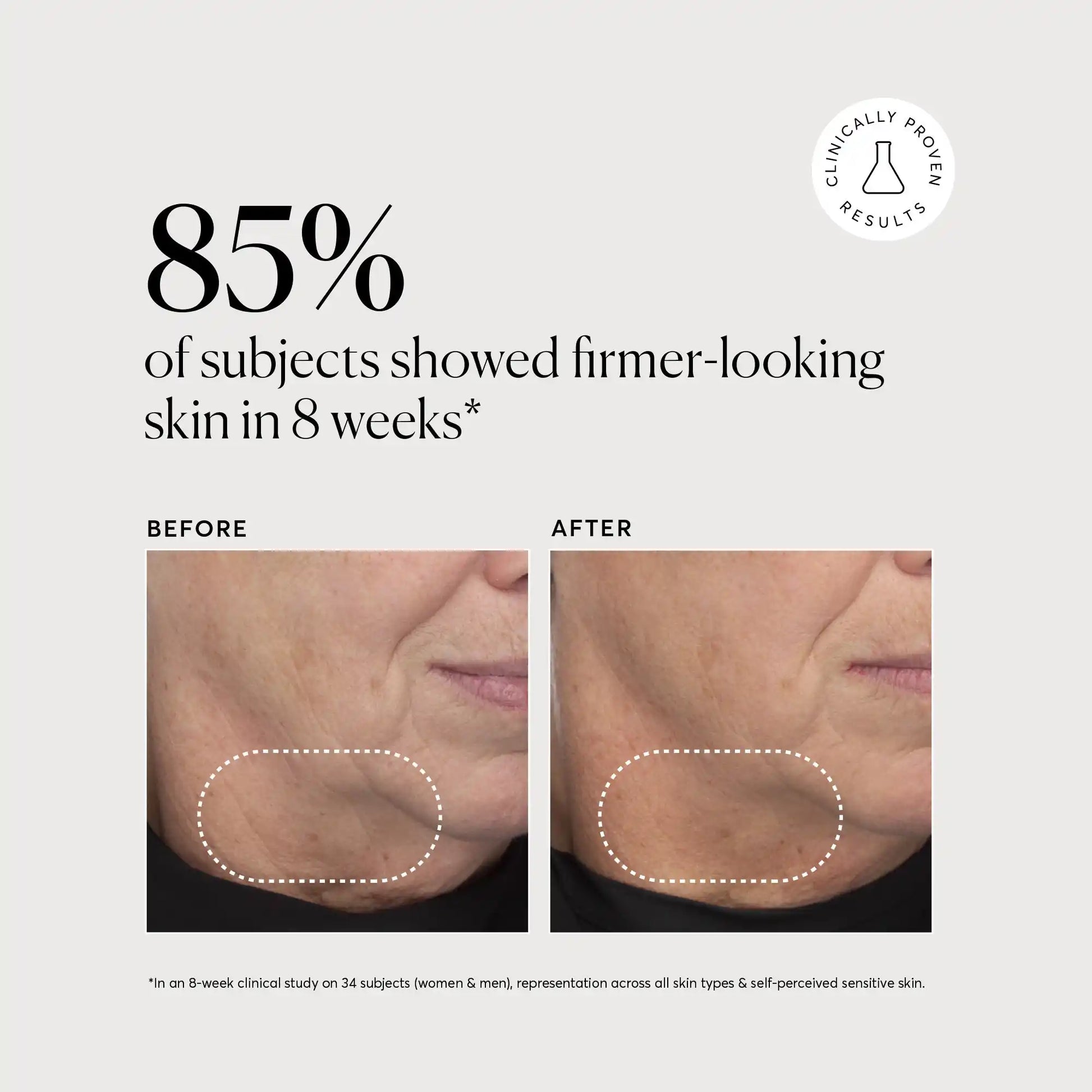 retinol-complex-serum-u8 NATR-10034-Alt-Images-Retinol-Complex-Serum-04.webp